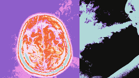 Collage featuring a brain scan and an image of a shaman blowing smoke during an ayahuasca ceremony.