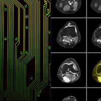 Green circuit board pattern on the left side; series of nine MRI scans on the right, with one image highlighted in yellow.