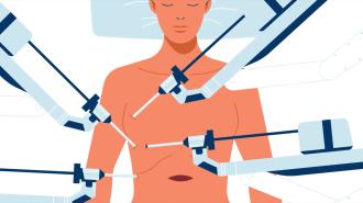 an illustration of a patient receiving a lung transplant by four robotic arms