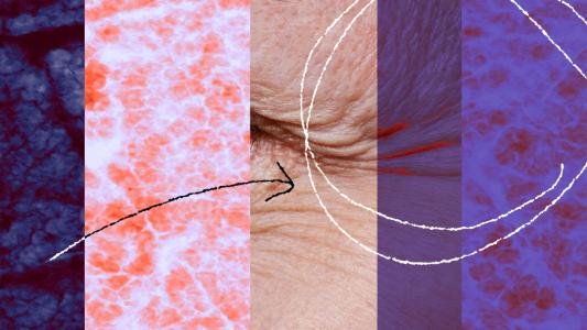 a collage featuring cells under a microscope and a close up of wrinkles on a person's face